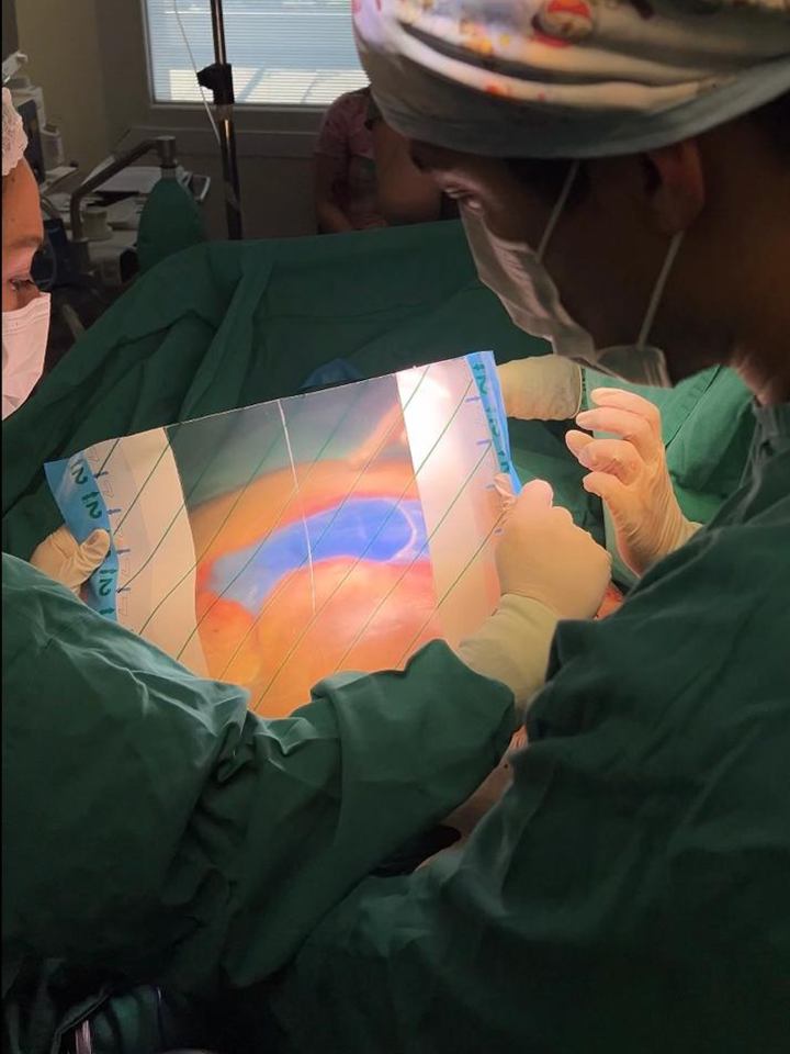 Instalación de una terapia de presión negativa